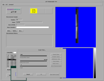 scoutview
