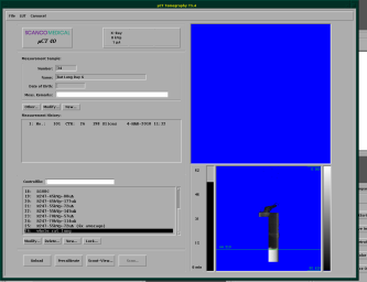 Tomography Window